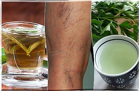 5 infusions to fight varicose veins