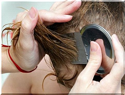 7 natural remedies to get rid of head lice and nits in no time