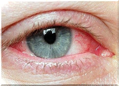 What are the causes of corneal tumors?