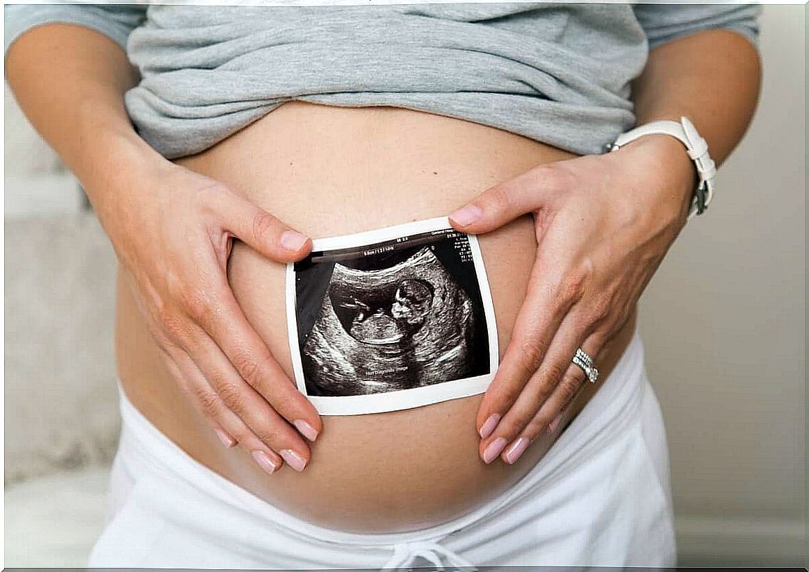 Pregnant woman holding ultrasound picture.