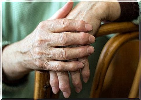 Arthritic Hands Treated by Ginger