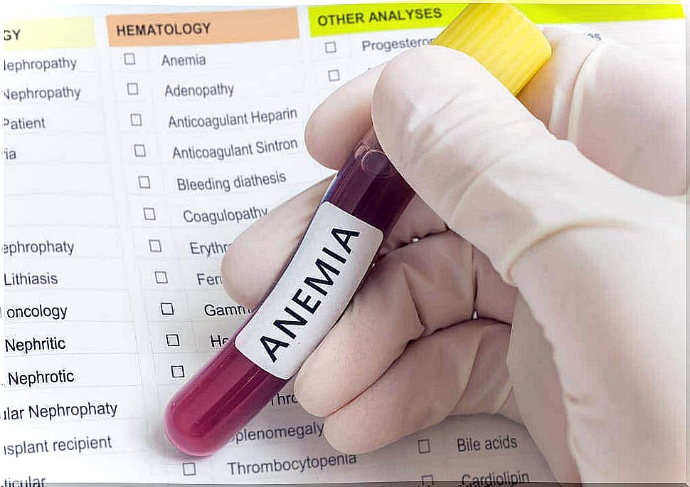 Exam to detect anemia