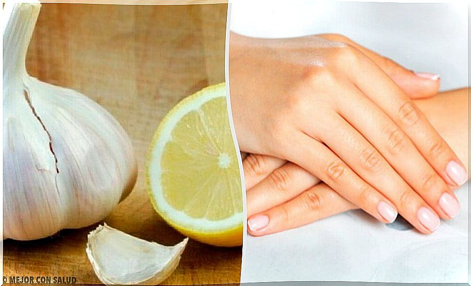 Natural Remedies for Weak Nails