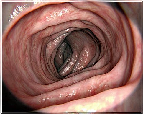 Large intestine