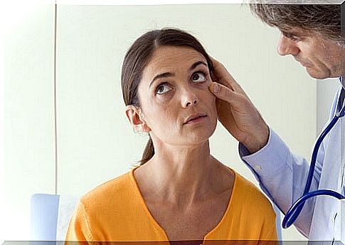 Woman with signs of iron deficit in her eyes