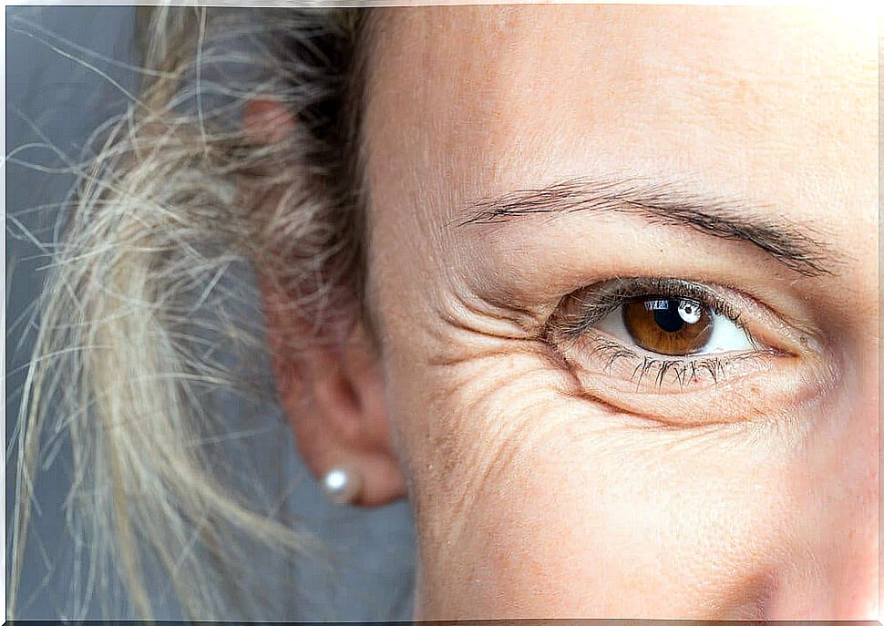 facial wrinkles in eyes