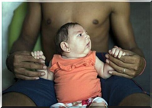 Zikavirus can cause microcephaly