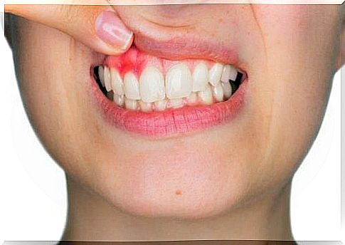 Gum inflammation